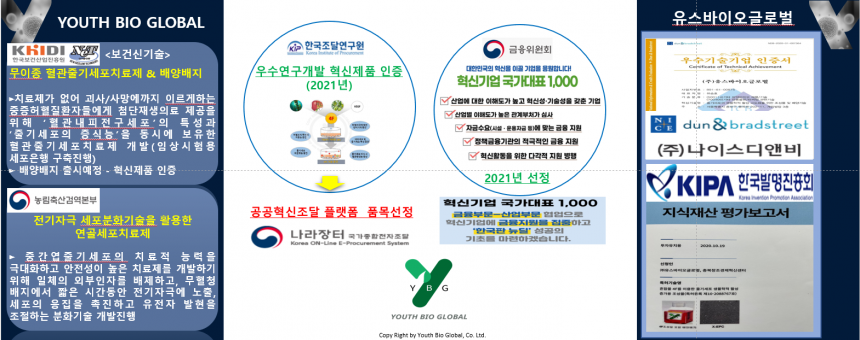 혁신기업 국가대표 1000